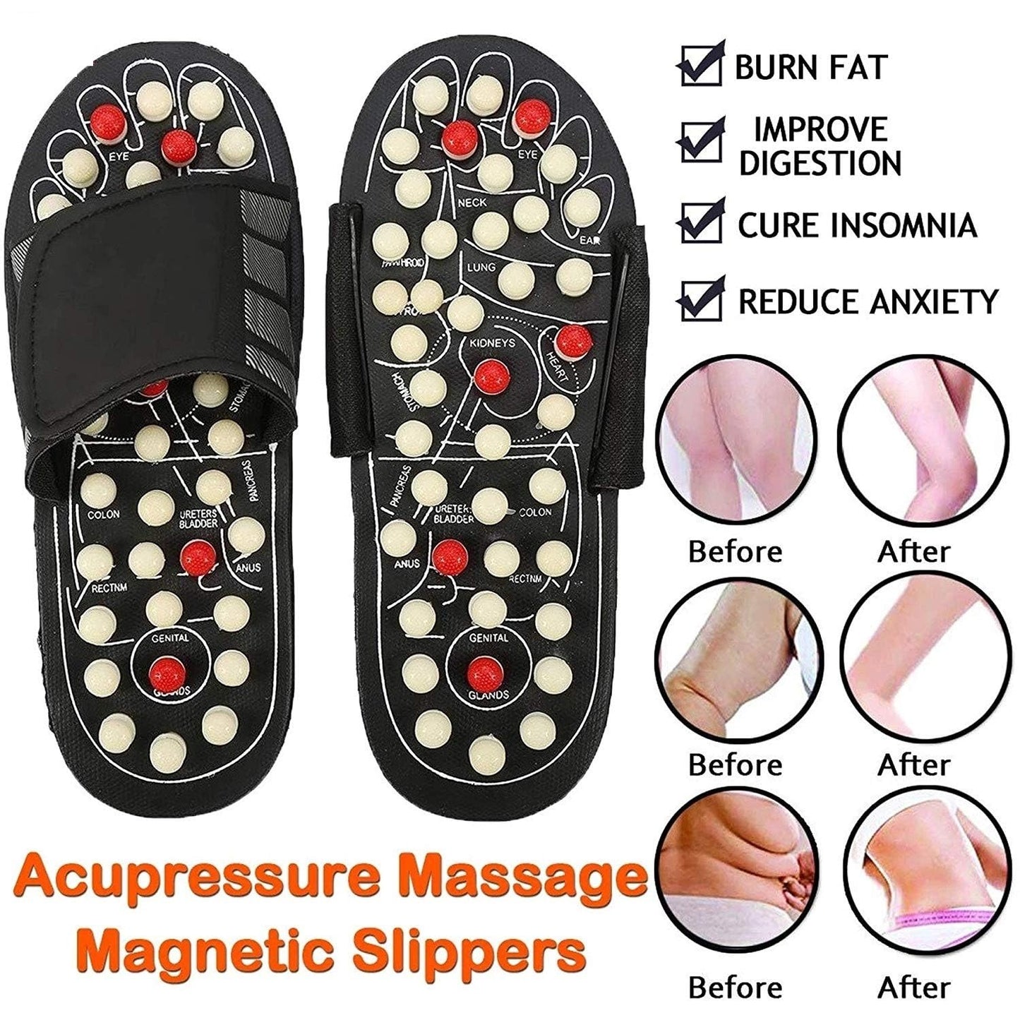Chaussons d'acupression et de magnétothérapie